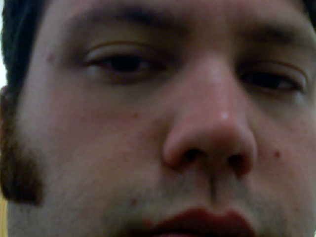 Nose +